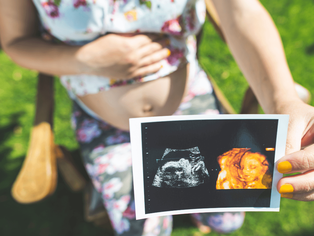 pregnant woman holding ultrasound picture